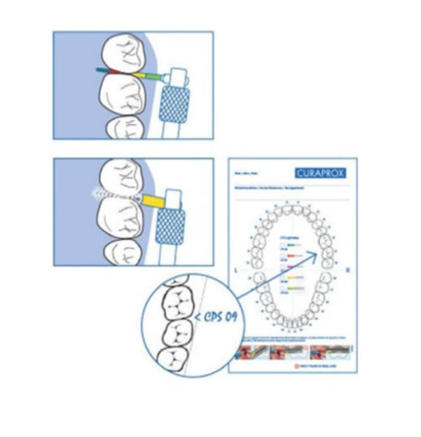 Sonda Curaprox IAP Pime x 5 un autoclavable