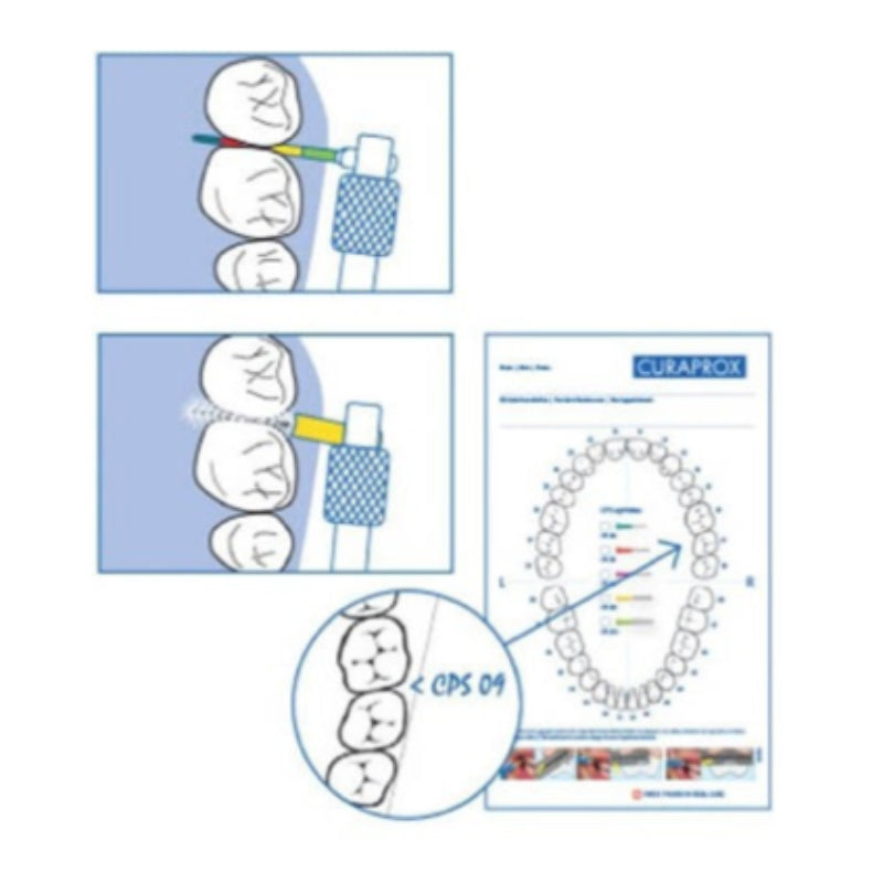 Sonda Curaprox IAP Perio x 12 unidades Autoclavable