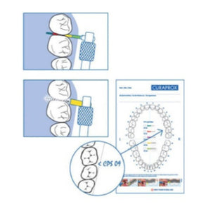 Sonda Curaprox IAP Perio x 12 unidades Autoclavable